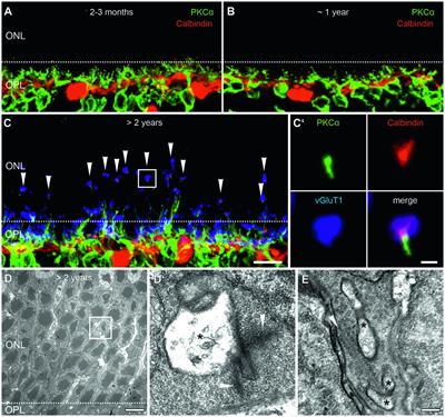 The first synapse in vision in the aging mouse retina